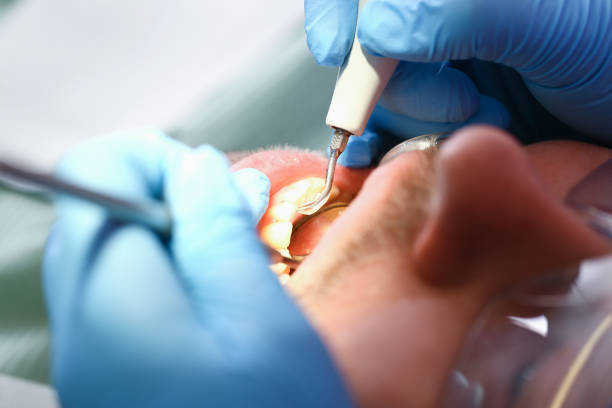 Best Emergency Dental Care for Abscessed Tooth in Jackson, MS