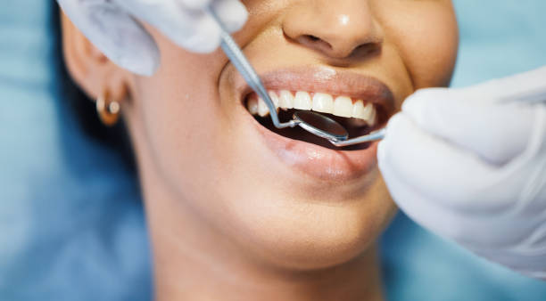 Best Emergency Dentist for Lost Fillings or Crowns in Jackson, MS