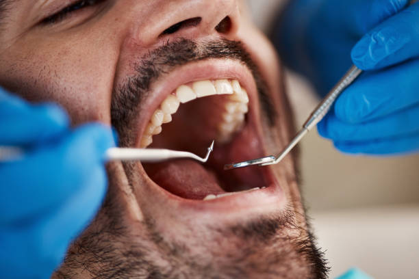 Best Emergency Dental Extractions in Jackson, MS